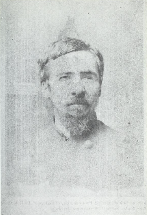 A bearded, middle-aged white man with left eye blinded and scars on his cheek.