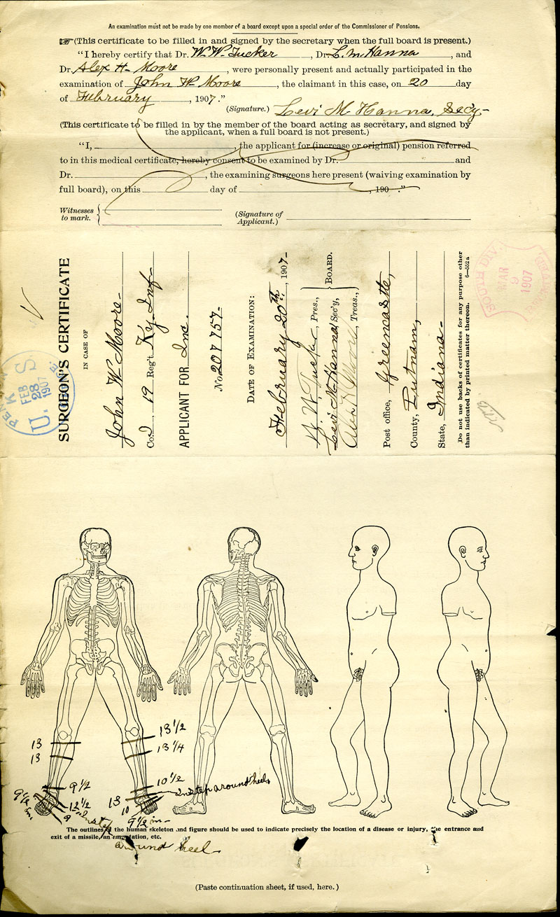 "A surgeon's certificate of the Commissioner of Pensions for John W. Moore applicant for, "Inc.", by Dr. Tucker and Dr. Hanna. Shows detailed handwritten notes on the pre-printed image of a skeleton about injuries to both legs below the knees. "