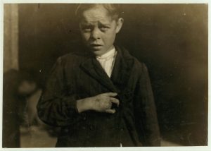 portrait of a child with disabilities