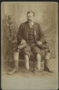 Man sitting on chair in suit with prosthetic legs.