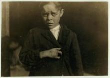 A boy squints in bright sunlight, his dark jacket held closed by his right hand across his chest, showing his thumb, pointer, and pinky fingers with the scar between them where two fingers are missing.